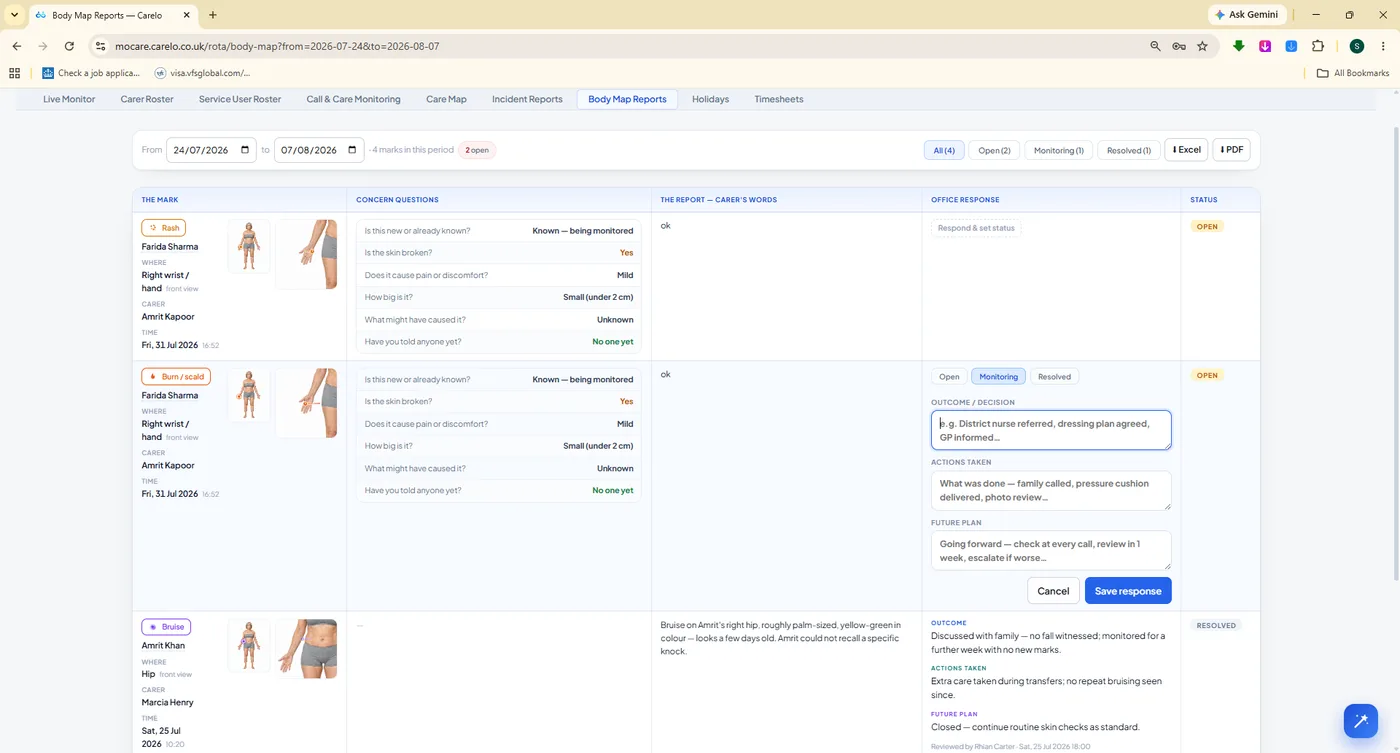 Body map reports with body figures, concern questions and status workflow